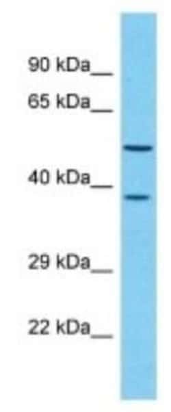 OR4D1 Rabbit anti-Human, Polyclonal, Novus Biologicals 100 &mu;g; Unconjugated:Antibodies,